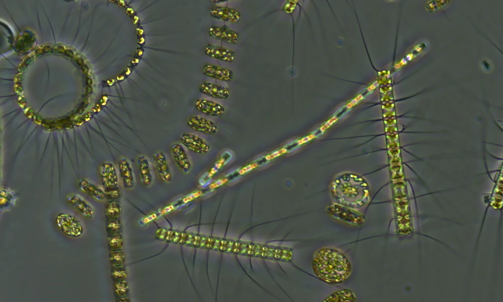 what phytoplankton look like